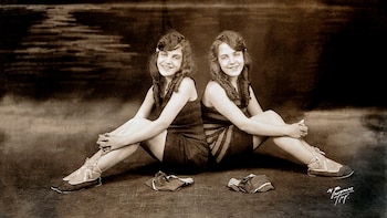 Daisy y Violet Hilton, las gemelas siamesas a las que convirtieron en figuras del espectáculo desde la infancia
