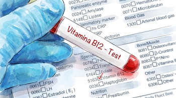 Una mano con guante azul sostiene un tubo de ensayo blanco con líquido rojo. En el tubo se lee "Vitamina B12 - Test". Detrás, un formulario médico con opciones marcadas.