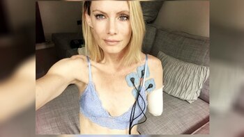 La doble sufrió múltiples lesiones