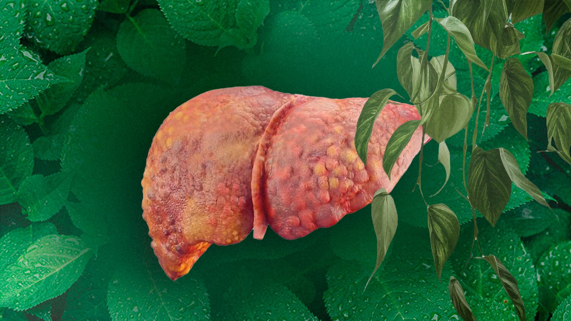 Hígado inflamado: reduce la grasa acumulada con estas 3 frutas que controlan el colesterol y diabetes (Foto: Infobae México/ Jovani Pérez)