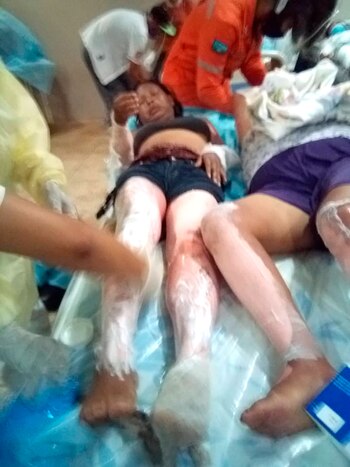 Entre los heridos hay al