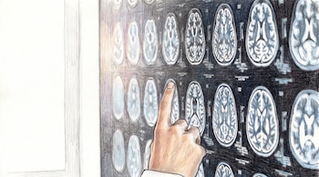 Ilustración de una mano apuntando a una pantalla con múltiples imágenes ovaladas de resonancia magnética de cerebros sobre fondo oscuro.