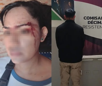 Composición de dos fotos: a la izquierda una persona con el rostro lesionado y a la derecha un hombre de espaldas dentro de una comisaría