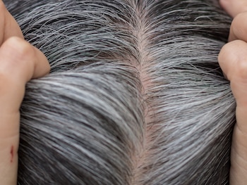5 señales sutiles de que el cuerpo necesita más nutrientes, según un médico de Harvard 12 El cabello gris a temprana edad se relaciona con deficiencias de vitamina B12 o cobre, cruciales para transportar oxígeno y producir melanina
