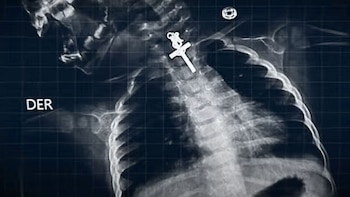 Radiografía. La Ley 31188 regula