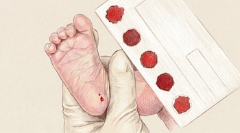 Una mano enguantada sostiene el pie de un bebé del cual cae una gota de sangre hacia una tarjeta con cinco círculos rojos de sangre.