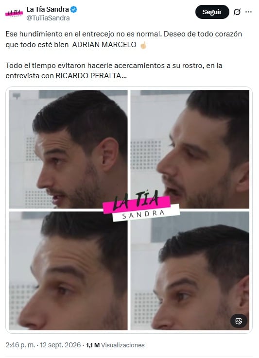 Adrián Marcelo causa preocupación por un supuesto hundimiento en el rostro (X/@TuTiaSandra)