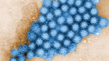 Micrografía electrónica que muestra una acumulación de partículas virales de Norovirus de color azul vibrante sobre un fondo granulado beige