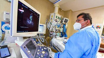 Los expertos recomiendan a los