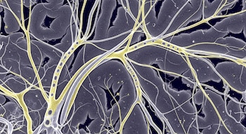 El estudio de la Universidad