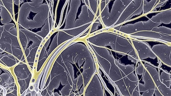 Identifican una proteína clave en el envejecimiento cerebral y abren nuevas vías para combatir el deterioro cognitivo