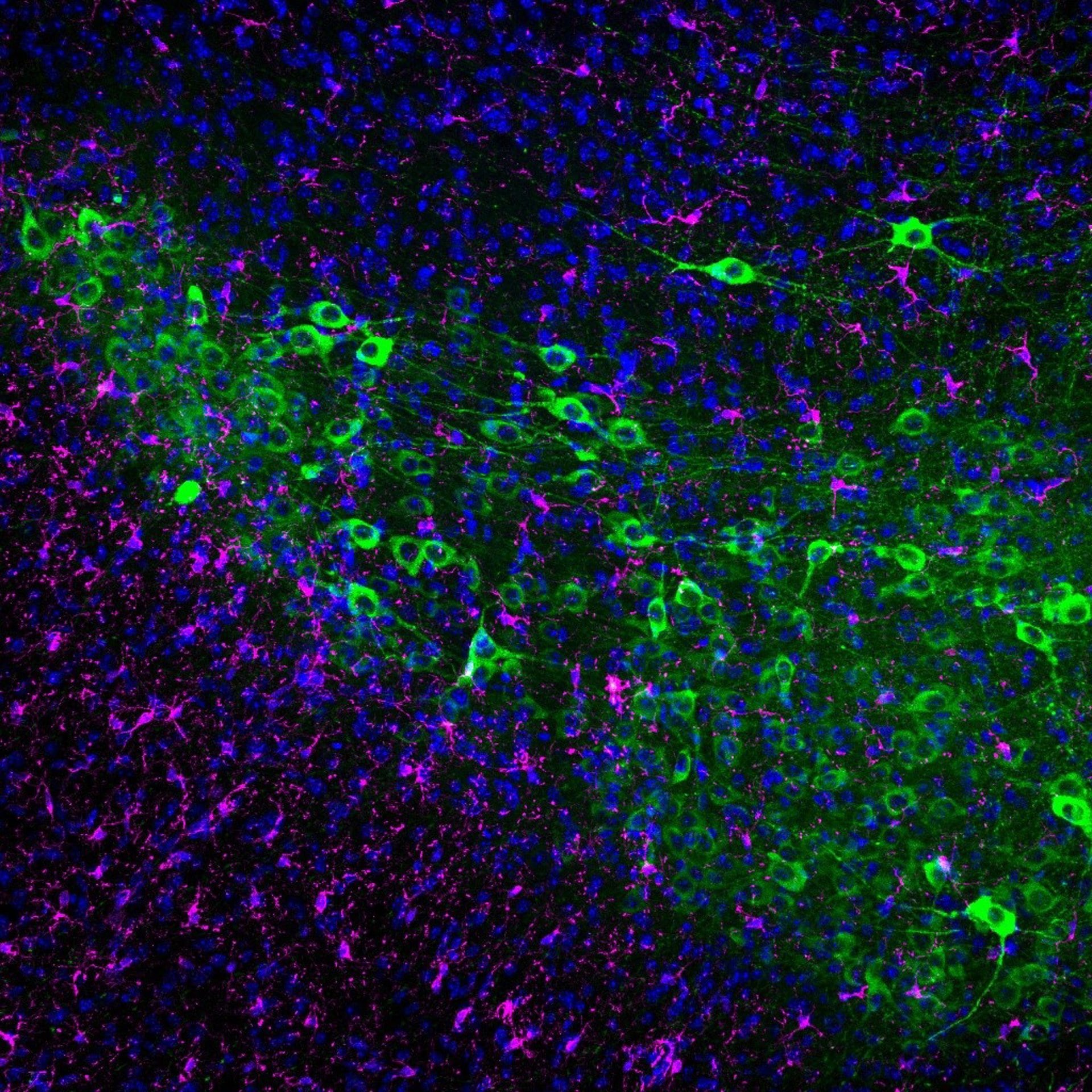 Los pacientes tratados antes de las 15 horas permanecieron sin empeoramiento del cáncer durante 11,3 meses frente a 5,7 meses del grupo vespertino (Europa Press)
