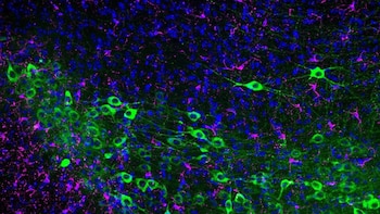 Descubren que el tratamiento de