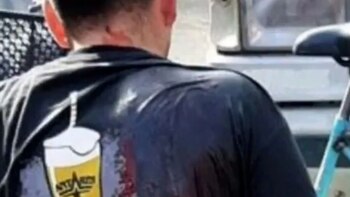 El cartero fue apuñalado en