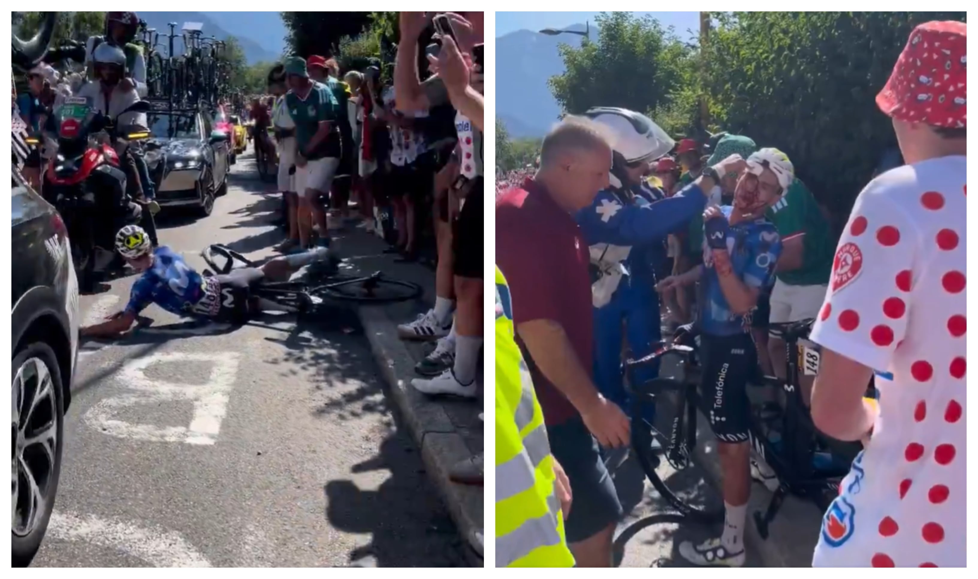 Estos son los resultados médicos de Einer Rubio tras su accidente en el Tour de Francia: rompió un vidrio con su cara