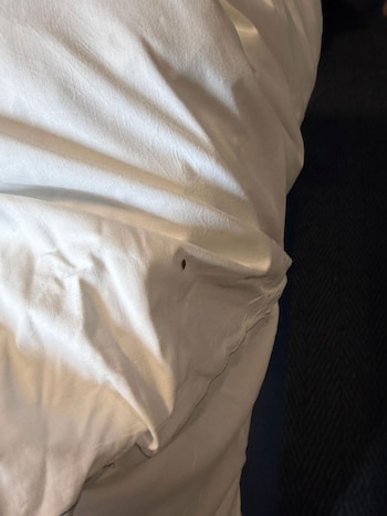 Fue a un hotel por una noche y terminó cubierta de picaduras de chinches