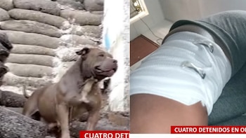 Un perro de pelaje marrón junto a varios sacos y una extremidad humana vendada con ganchos metálicos