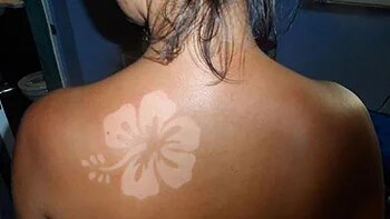 Los expertos no recomiendan hacerse un tatuaje solar, ya que provoca numerosos problemas para la dermis
