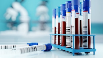 Panel de la FDA respalda con poco margen la prueba de sangre para cáncer a pesar de dudas sobre su eficacia
