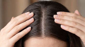 Dos manos con uñas naturales separan cabello oscuro en la parte superior de la cabeza, mostrando el cuero cabelludo