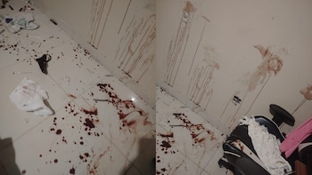 Manchas de sangre sobre el piso y paraderes de la habitación en la que la víctima fue agredida. (Foto composición: Infobae Perú/FB:@
Voces)