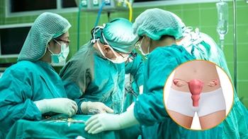 Extirpan el útero por error