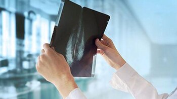 Una nueva IA detecta el