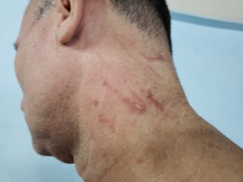 Heridas perpetradas por las fuerzas