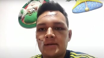 Las heridas de Felipe Roa. Foto: Semana
