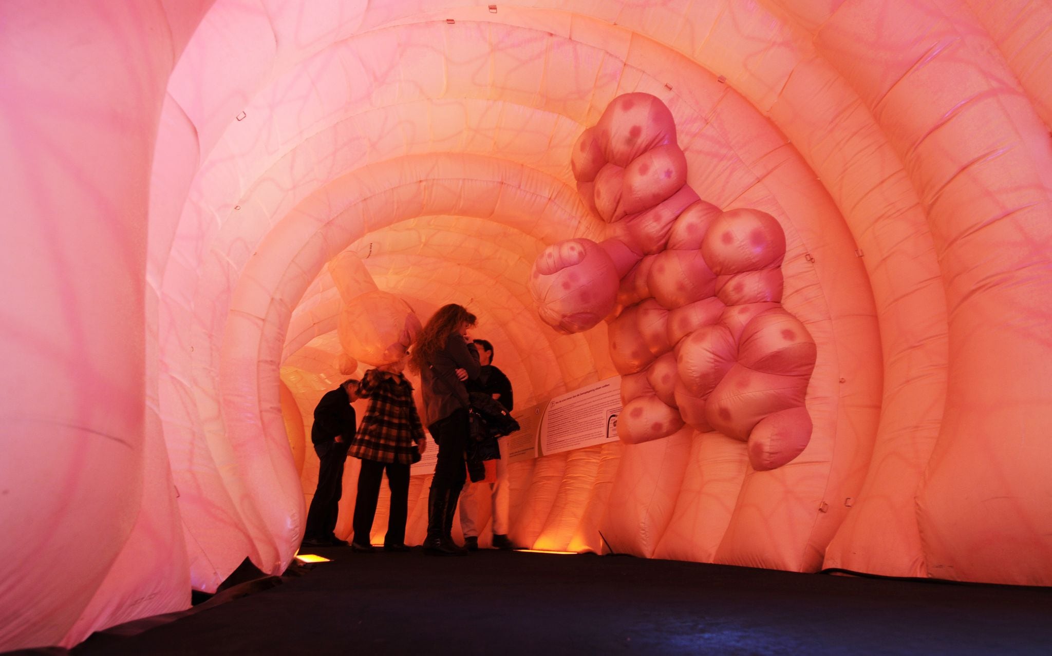 La enfermedad puede comenzar en pólipos benignos que tardan hasta quince años en volverse malignos, ventana clave para detectarlos - Christian Charisius/dpa