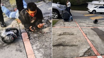 Así quedó el asaltante golpeado