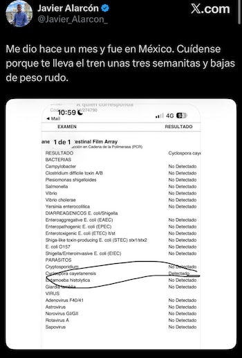 Un estudio clínico de Javier Alarcón detecta el parásito Cyclospora cayetanensis como causa de la ciclosporiasis. (X/ @Javier_Alarcon_)