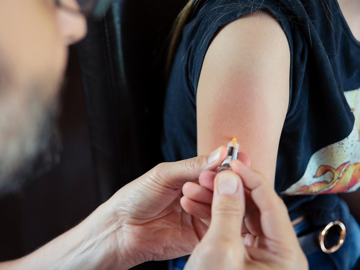 Cómo funcionan las 4 vacunas desarrolladas para prevenir el HPV - Infobae