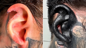 Se sometió a diversas cirugías para cambiar radicalmente su apariencia: se quitó la nariz y se agrego cuernos