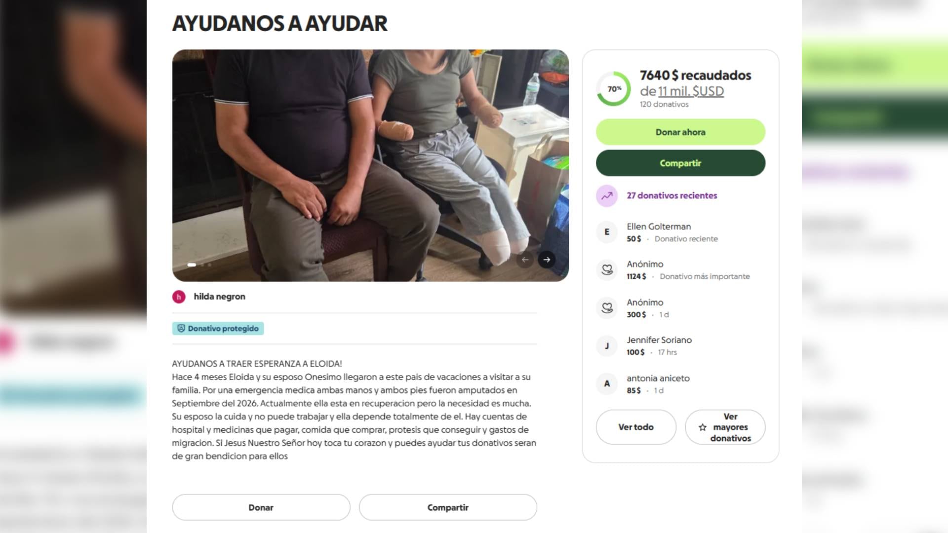 La familia de la paciente inició una recaudación de fondos en GoFundMe para adquirir las prótesis requeridas.