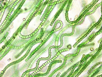 Un tipo de cianobacteria presente