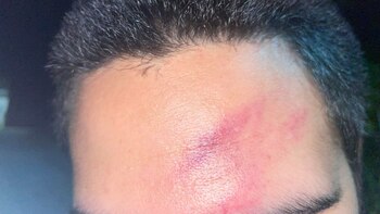 Scandale, coups et même arme