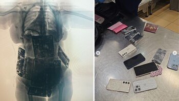 Los rayos X descubrir los