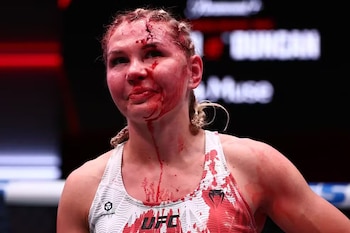 Una mujer con trenzas en el cabello presenta un corte en la frente, sangre en la cara y en su camiseta deportiva blanca