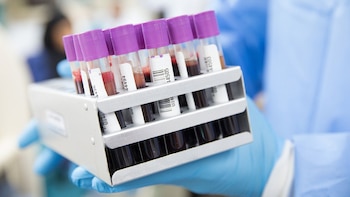 El aprendizaje automático podría ayudar a identificar a personas con mayor riesgo de desarrollar cáncer, según estudio
