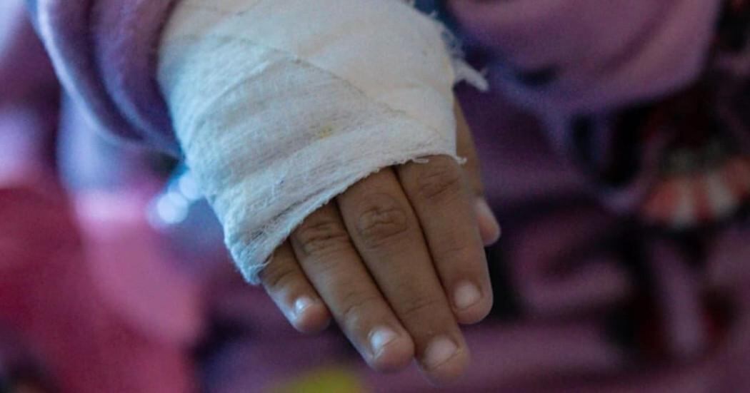 El uso irresponsable de pólvora deja en evidencia los riesgos para los niños durante la temporada de fin de año en la ciudad - crédito Alcaldía de Bogotá