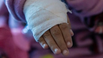 Tres menores permanecen en UCI