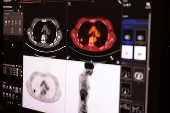 Las imágenes y los reportes médicos del Ciclotrón PET/CT se entregan en un máximo de siete días hábiles y en menos de 24 horas para casos urgentes. Crédito: UCR