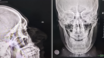 Iquitos - PNP - Agresión - Perú - 22 abril