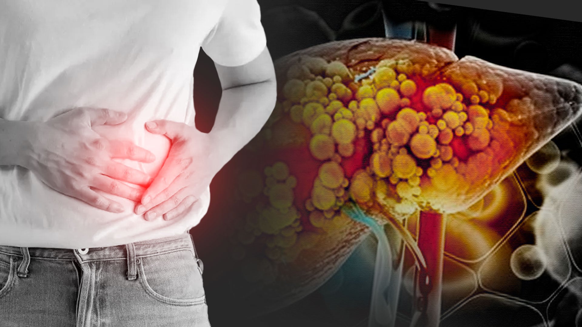 La enfermedad hepática grasa asociada a disfunción metabólica (MASLD) prevalece en una de cada tres personas adultas en Reino Unido y Estados Unidos (Foto: Infobae México/ Jesús Aviles)