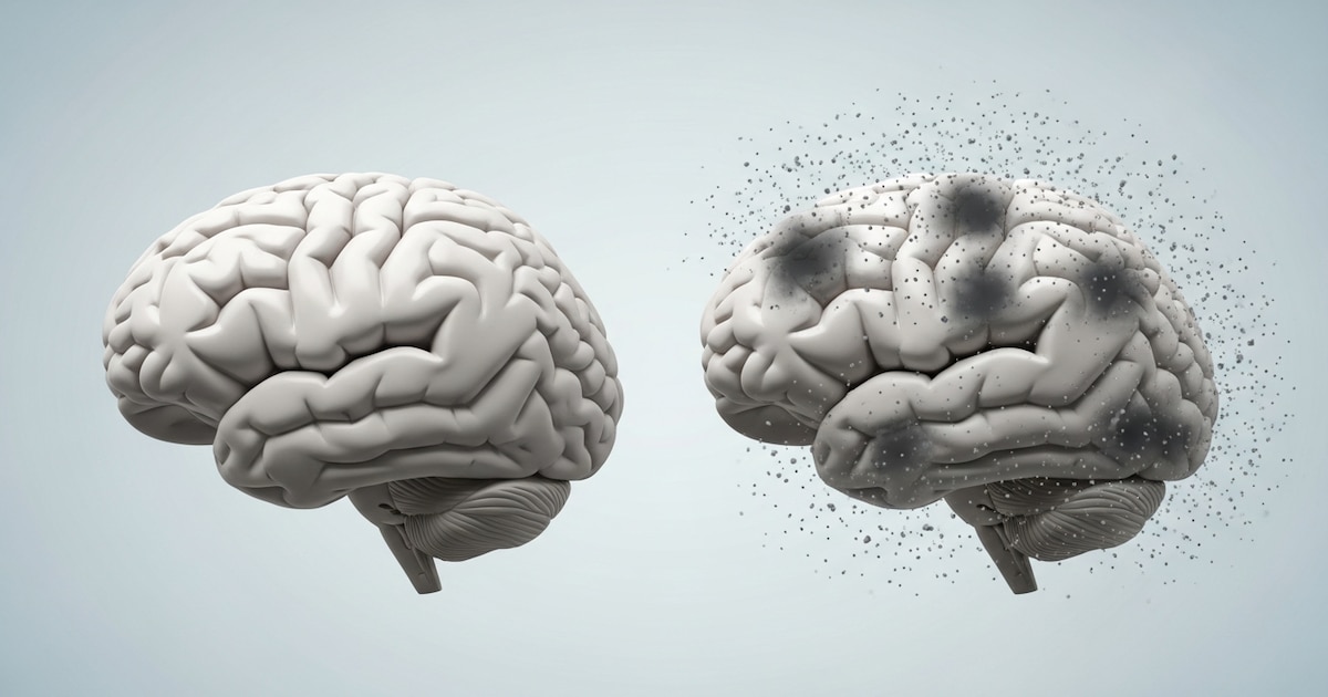 MODELOS CELULARES ARGENTINOS AVANZAN EN INVESTIGACIÓN ALZHEIMER