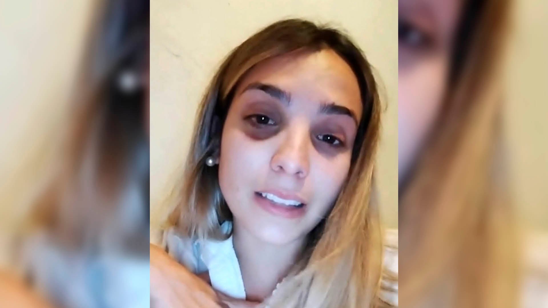 Emily en su momento mostró los moretones y los golpes que le dejó su exmarido (Captura de video)