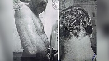 En la revisión médica al