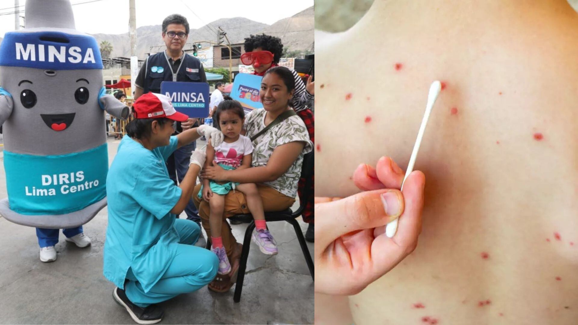 Vacunarán contra el sarampión.