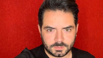 José Eduardo Derbez confessed that he suffers from alopecia: he would have a hair graft